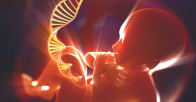 chromosomal abnormalities